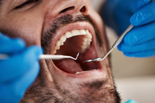 Emergency Dentist for Kids in GA